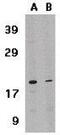 Interleukin-21 antibody, GTX85088, GeneTex, Western Blot image 