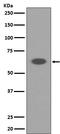 Apoptosis Inducing Factor Mitochondria Associated 1 antibody, M01571, Boster Biological Technology, Western Blot image 