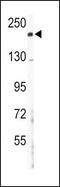 Collagen Type V Alpha 2 Chain antibody, PA5-14245, Invitrogen Antibodies, Western Blot image 