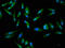 FASN antibody, LS-C370773, Lifespan Biosciences, Immunofluorescence image 