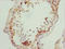 RUN And FYVE Domain Containing 2 antibody, LS-C676438, Lifespan Biosciences, Immunohistochemistry paraffin image 