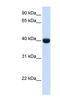 Alcohol Dehydrogenase 1A (Class I), Alpha Polypeptide antibody, NBP1-57671, Novus Biologicals, Western Blot image 