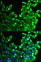 FGFR-2 antibody, STJ23658, St John