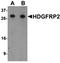 Hepatoma-derived growth factor-related protein 2 antibody, orb75638, Biorbyt, Western Blot image 