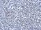 Arginine And Serine Rich Protein 1 antibody, NBP2-15641, Novus Biologicals, Immunohistochemistry paraffin image 
