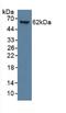 Keratin 9 antibody, LS-C690958, Lifespan Biosciences, Western Blot image 