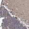 TWIST Neighbor antibody, HPA022416, Atlas Antibodies, Immunohistochemistry paraffin image 