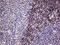 FOS Like 2, AP-1 Transcription Factor Subunit antibody, M02615, Boster Biological Technology, Immunohistochemistry paraffin image 