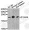 S100 Calcium Binding Protein A9 antibody, A9842, ABclonal Technology, Western Blot image 