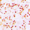 Centromere Protein A antibody, LS-C354603, Lifespan Biosciences, Immunohistochemistry paraffin image 