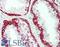 Keratin 5 antibody, LS-B14231, Lifespan Biosciences, Immunohistochemistry paraffin image 