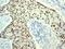 Estrogen Receptor 1 antibody, ab108398, Abcam, Immunohistochemistry paraffin image 