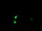 SSX Family Member 5 antibody, M15233, Boster Biological Technology, Immunofluorescence image 