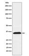 Peroxisomal Biogenesis Factor 19 antibody, M03186, Boster Biological Technology, Western Blot image 