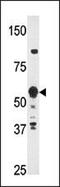 Zinc Finger Protein 395 antibody, GTX82520, GeneTex, Western Blot image 