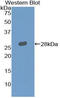 Leukocyte Immunoglobulin Like Receptor A2 antibody, LS-C295149, Lifespan Biosciences, Western Blot image 