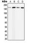 Phospholipase C Beta 3 antibody, MBS821418, MyBioSource, Western Blot image 