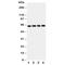 Sequestosome 1 antibody, R31058, NSJ Bioreagents, Western Blot image 