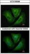 Major Histocompatibility Complex, Class II, DR Beta 3 antibody, LS-C185683, Lifespan Biosciences, Immunocytochemistry image 