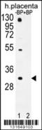 Olfactory Receptor Family 1 Subfamily D Member 5 antibody, 56-174, ProSci, Western Blot image 