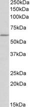 Tryptophan Hydroxylase 2 antibody, LS-C154853, Lifespan Biosciences, Western Blot image 