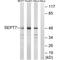 Septin-7 antibody, A09070, Boster Biological Technology, Western Blot image 