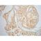 Galectin 3 antibody, LS-C387338, Lifespan Biosciences, Immunohistochemistry paraffin image 