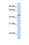 Transducin beta-like protein 2 antibody, NBP1-69369, Novus Biologicals, Western Blot image 