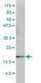 Prostaglandin E Synthase 3 antibody, LS-C134028, Lifespan Biosciences, Western Blot image 