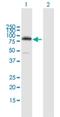 Protein Kinase C Eta antibody, H00005583-B02P, Novus Biologicals, Western Blot image 
