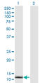 Cellular Retinoic Acid Binding Protein 2 antibody, LS-C139463, Lifespan Biosciences, Western Blot image 