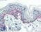 Keratin 5 antibody, LS-B3463, Lifespan Biosciences, Immunohistochemistry frozen image 