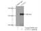 Clathrin Heavy Chain Like 1 antibody, 22283-1-AP, Proteintech Group, Immunoprecipitation image 