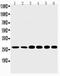 Sonic hedgehog protein antibody, PA5-79997, Invitrogen Antibodies, Western Blot image 