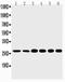 Sonic Hedgehog Signaling Molecule antibody, PA5-79997, Invitrogen Antibodies, Western Blot image 