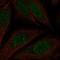 MAP kinase-interacting serine/threonine-protein kinase 2 antibody, HPA070499, Atlas Antibodies, Immunofluorescence image 