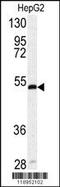 Serpin Family H Member 1 antibody, MBS9208399, MyBioSource, Western Blot image 