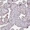 Na(+)/I(-) symporter antibody, HPA049055, Atlas Antibodies, Immunohistochemistry paraffin image 