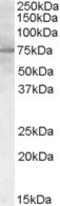 Proprotein Convertase Subtilisin/Kexin Type 9 antibody, 46-147, ProSci, Enzyme Linked Immunosorbent Assay image 