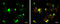 Growth Factor Independent 1 Transcriptional Repressor antibody, GTX133807, GeneTex, Immunocytochemistry image 