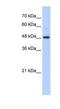 Abhydrolase Domain Containing 2 antibody, NBP1-53199, Novus Biologicals, Western Blot image 