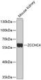 Zinc Finger CCHC-Type Containing 4 antibody, 13-458, ProSci, Western Blot image 