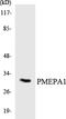 Prostate Transmembrane Protein, Androgen Induced 1 antibody, LS-C200502, Lifespan Biosciences, Western Blot image 