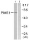 Protein Inhibitor Of Activated STAT 1 antibody, abx013223, Abbexa, Western Blot image 