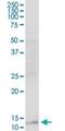 Retinol Binding Protein 5 antibody, H00083758-B01P, Novus Biologicals, Western Blot image 