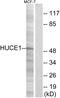 Ribosomal RNA Processing 8 antibody, GTX87185, GeneTex, Western Blot image 