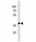 NK2 Homeobox 5 antibody, F53080-0.4ML, NSJ Bioreagents, Western Blot image 