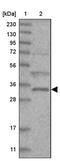 Zinc Finger AN1-Type Containing 2B antibody, PA5-57182, Invitrogen Antibodies, Western Blot image 