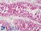 Cyclin Dependent Kinase 1 antibody, LS-B1179, Lifespan Biosciences, Immunohistochemistry paraffin image 