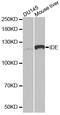 Insulin Degrading Enzyme antibody, MBS126584, MyBioSource, Western Blot image 